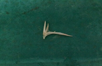 chicken-bone-nasopharynx chicken-bone-nasopharynx