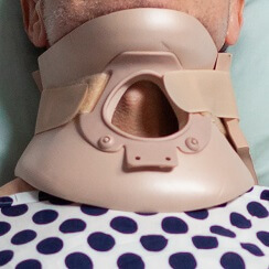 Tracheostomy Care